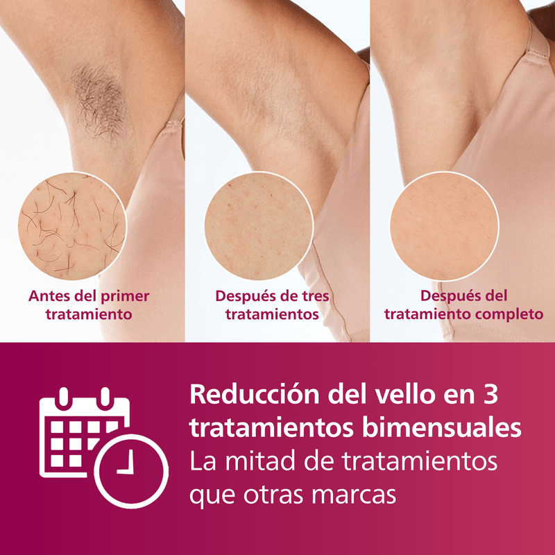 Philips lumea resultados sale