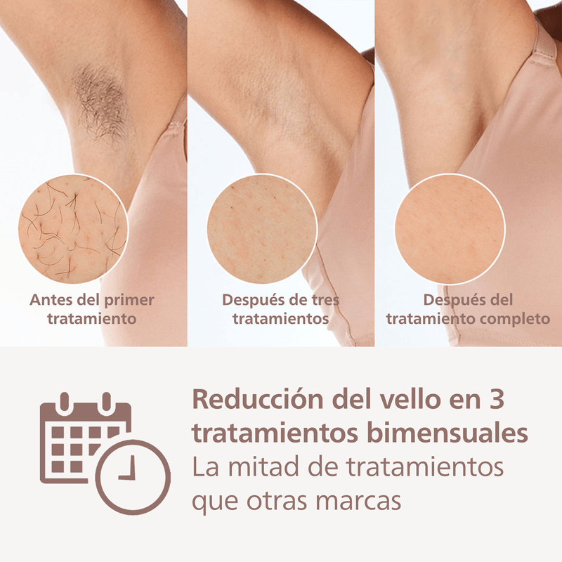 Diferencia entre depiladoras philips lumea sale